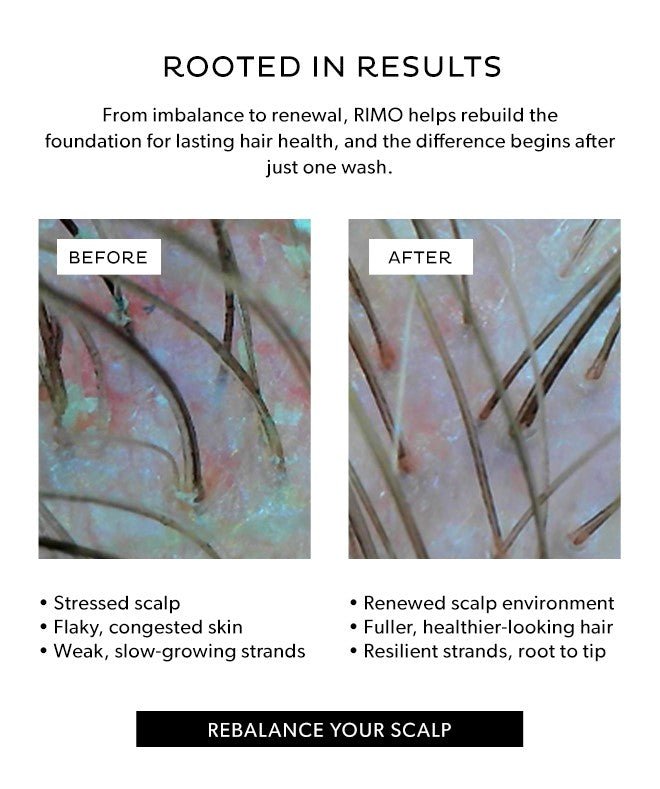 Abhati Suisse Rimo Scalp Trainer - Vorher und Nachher