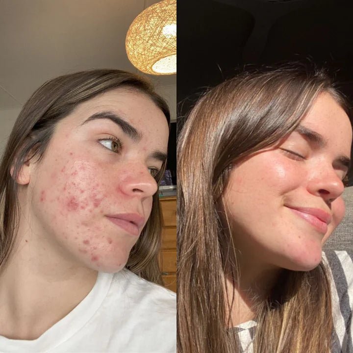 Eco By Sonya Glory Oil - Before and After Face