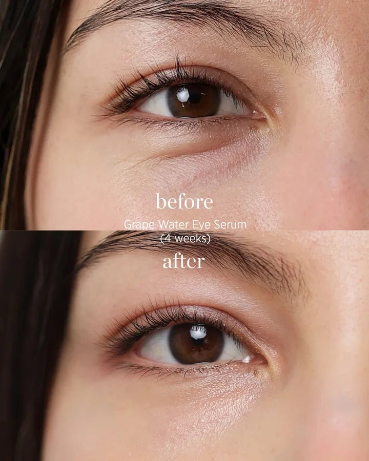 Ere Perez Grape Water Eye Serum - Model 2 Vorher und Nachher
