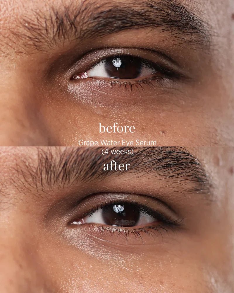 Ere Perez Grape Water Eye Serum - Model 3 Vorher und Nachher