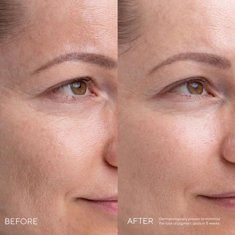 Mádara Kojic Alternative Pigment Serum - Vorher und Nachher