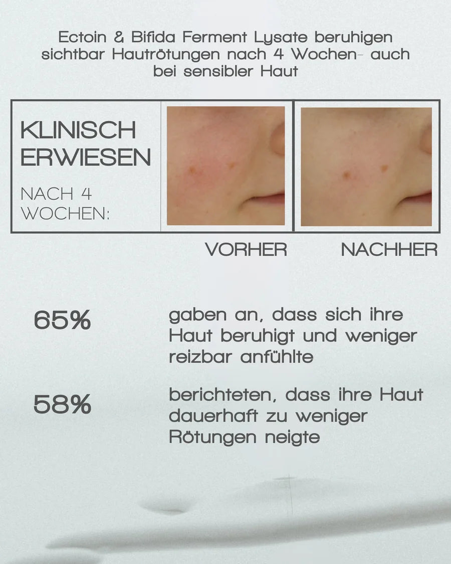 Merme Berlin More Moisture Face Serum - Beruhigung von Rötungen