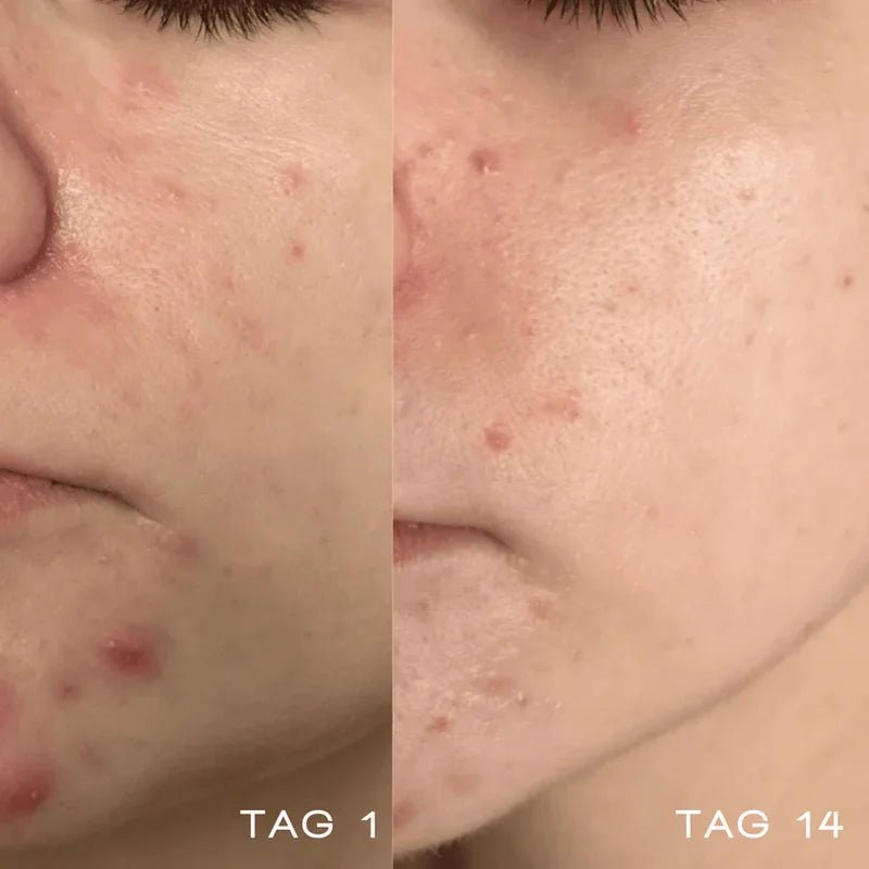 Oxygen Water before after