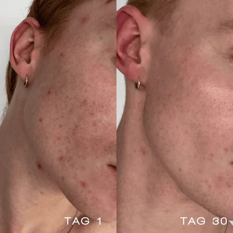 Oxygen Water Before and After