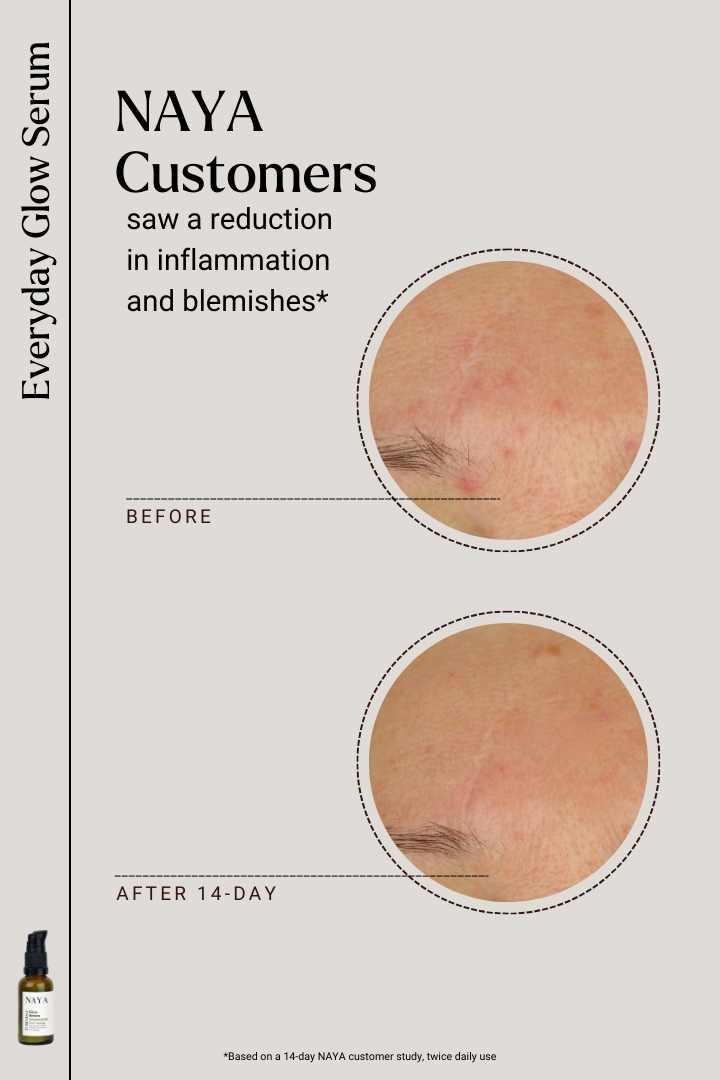 Naya Everyday Glow Serum Before After 2