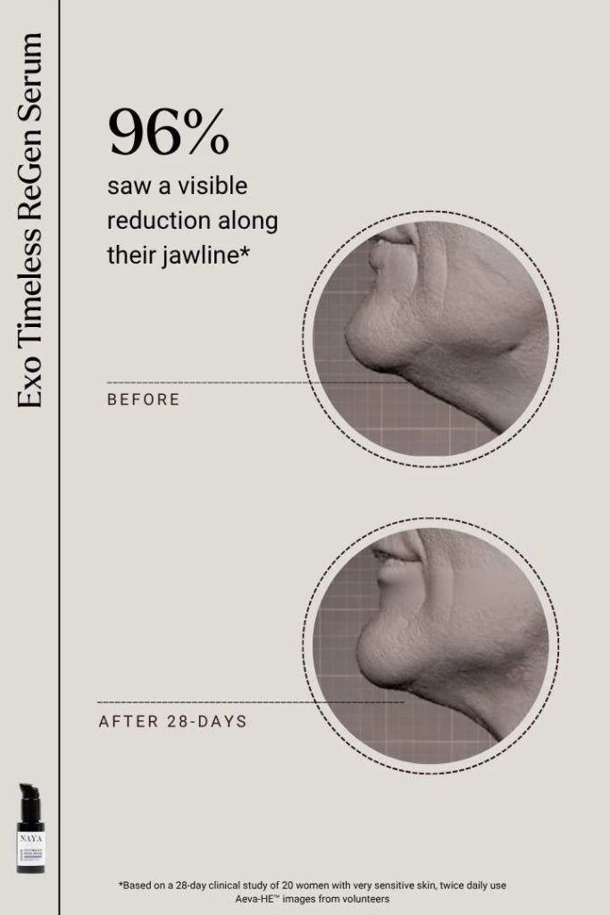 Exosomen Serum Resultate 2