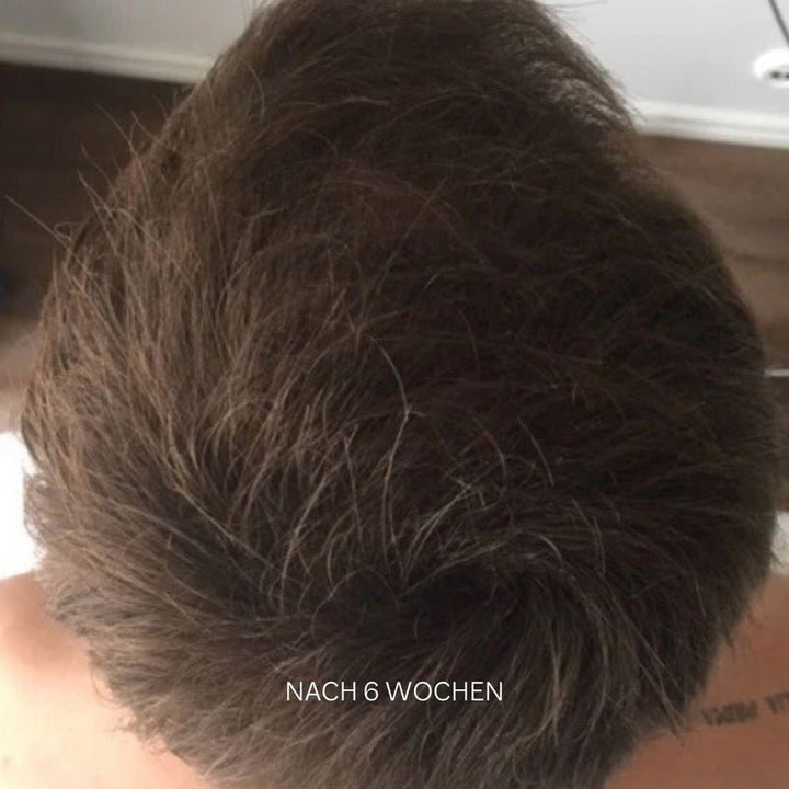 Grow & Shine Scalp Treatment Essence Nachher