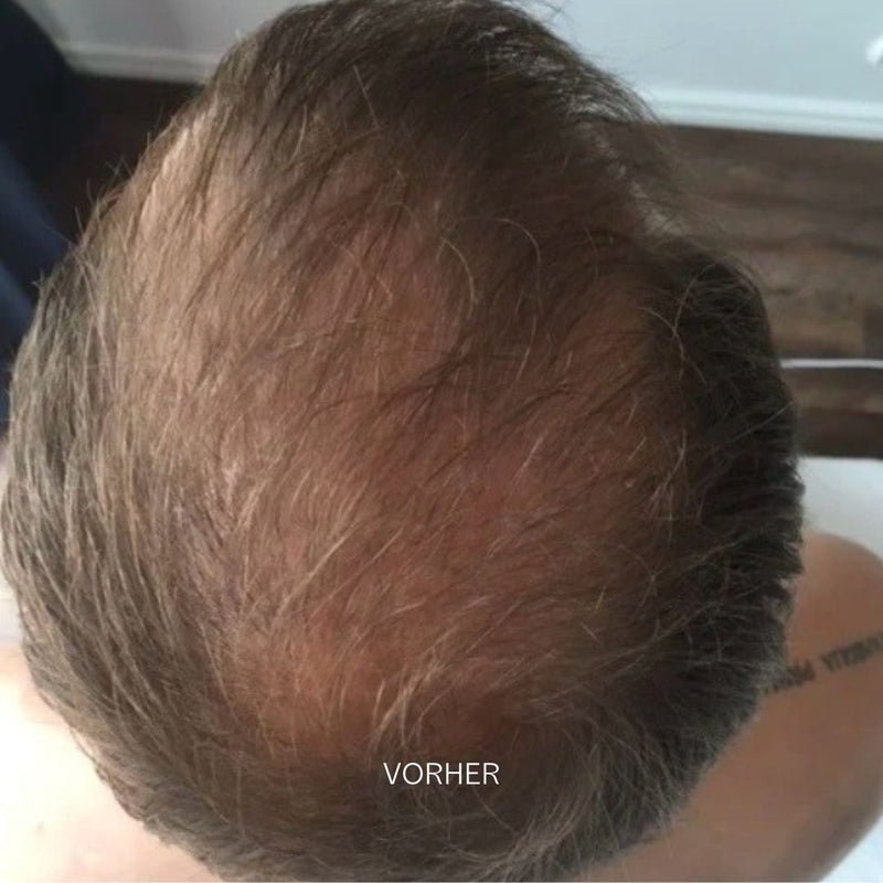 Grow & Shine Scalp Treatment Essence Vorher