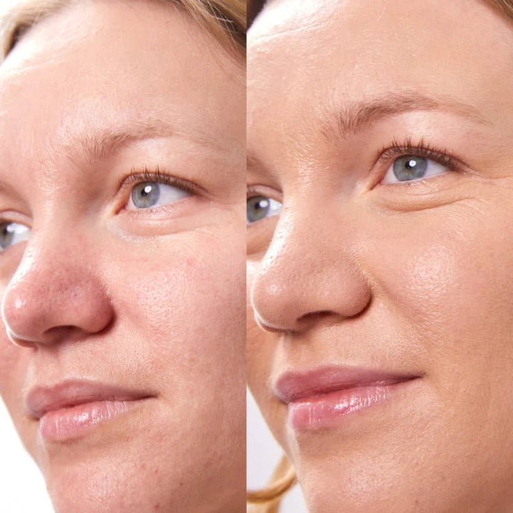 Concealer Balm Nr. 4.75 Model Before After