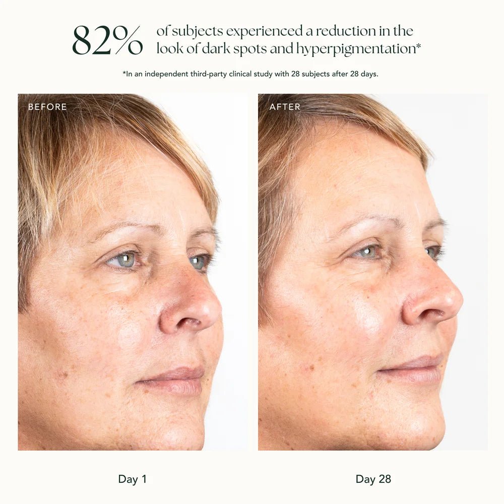 Ranavat Brightening Saffron Essence - Vorher und Nachher weibliches Model