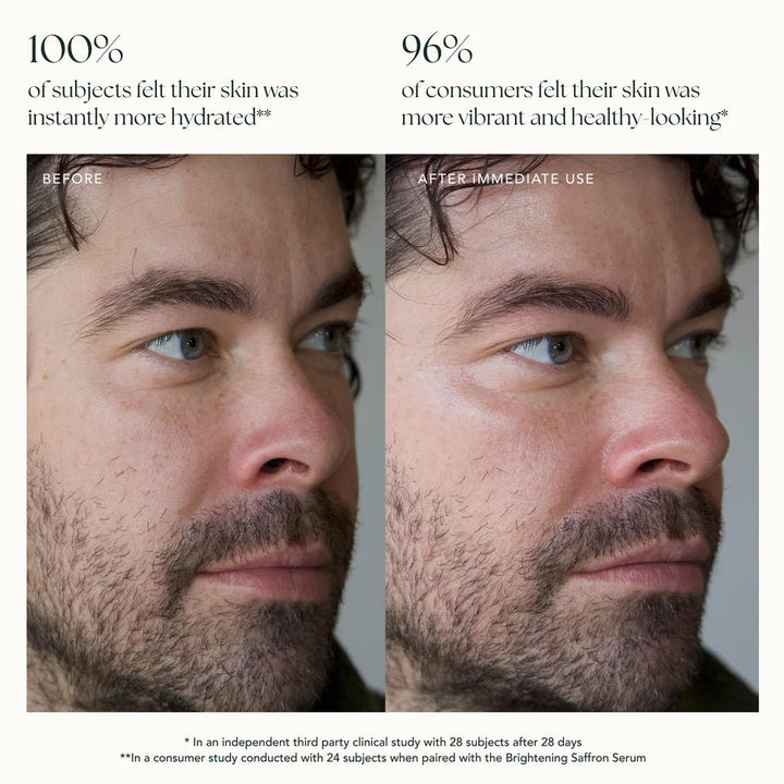 Ranavat Brightening Saffron Essence - Vorher und Nachher männliches Model