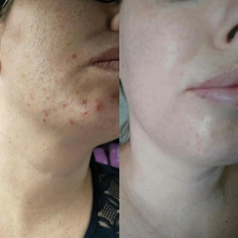 Eco By Sonya Super Citrus Cleanser Before After
