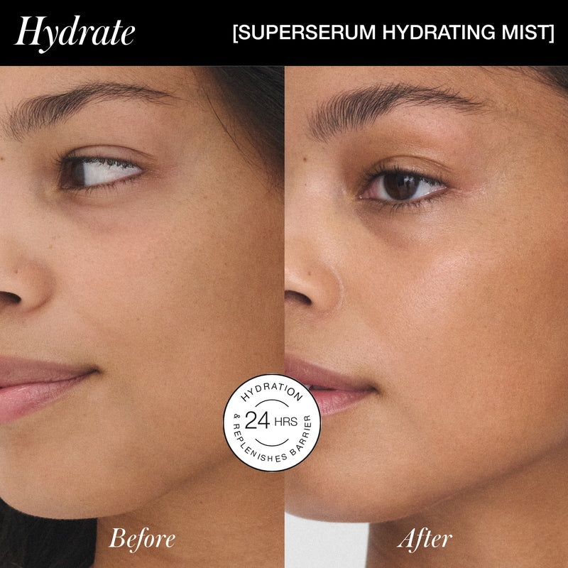 RMS Beauty SuperSerum Hydrating Mist Before After