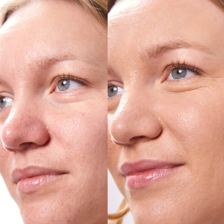 Concealer Balm Nr. 4.75 Cashew Vorher-Nachher - semi-mattes Finish für natürlichen Look