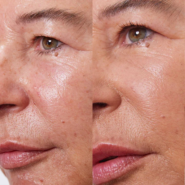 Concealer Balm Nr. 5 Hazel Vorher-Nachher - leichte bis mittlere Deckkraft für mittlere Haut