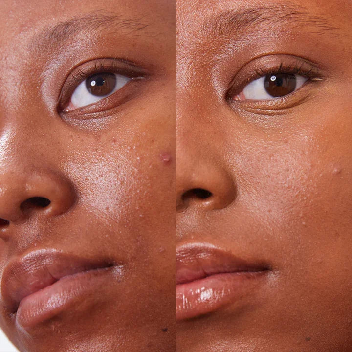 Concealer Balm Nr. 7 Amber Vorher-Nachher - semi-mattes Finish für dunkle Haut