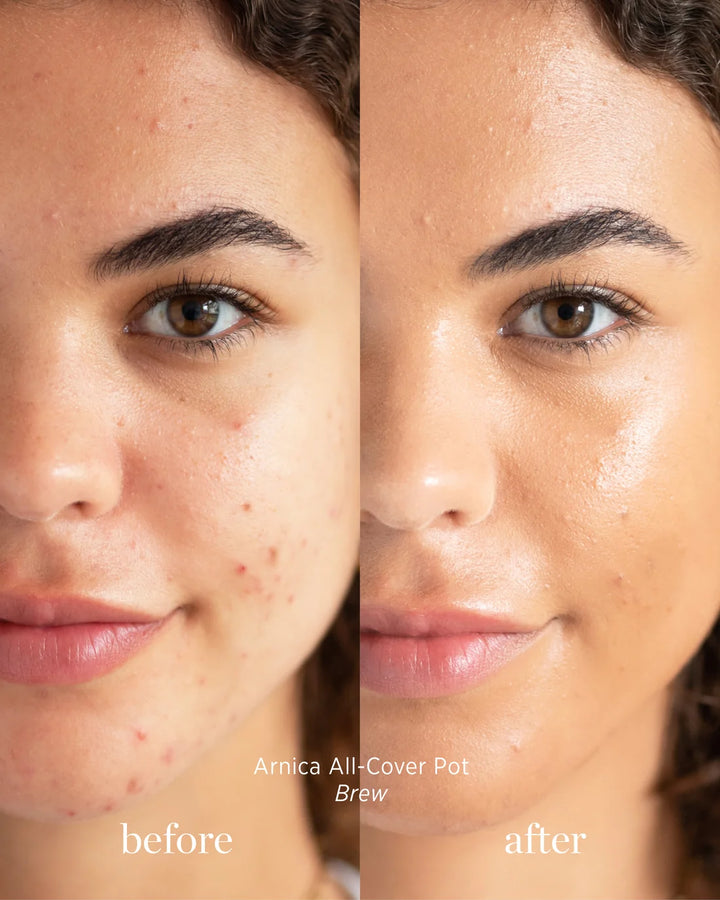 Ere Perez Arnica All-Cover Pot Brew Concealer Before After
