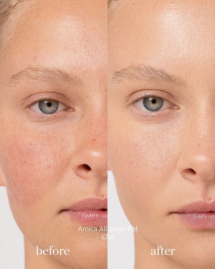 Arnica All-Cover Pot Chai Concealer Before After