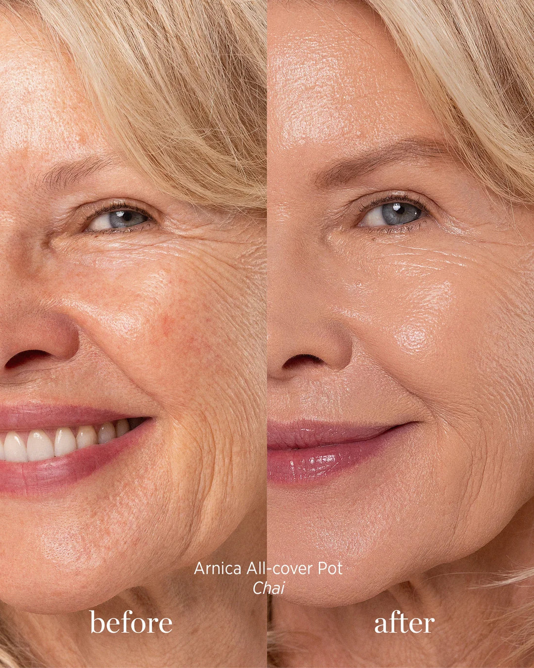 Arnica All-Cover Pot Chai Before and After application