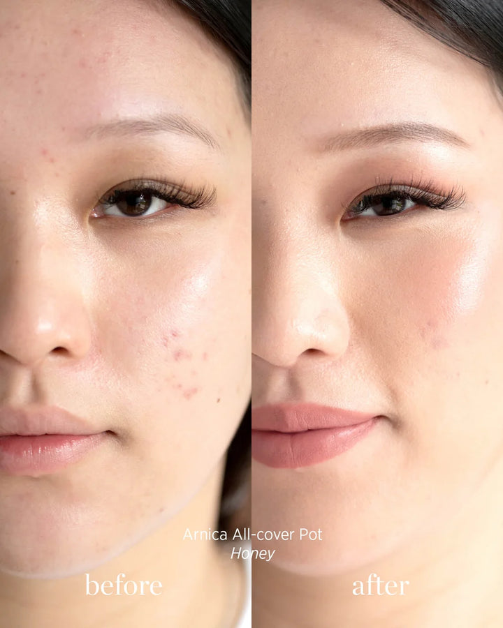Arnica All-Cover Pot Honey Concealer Before After