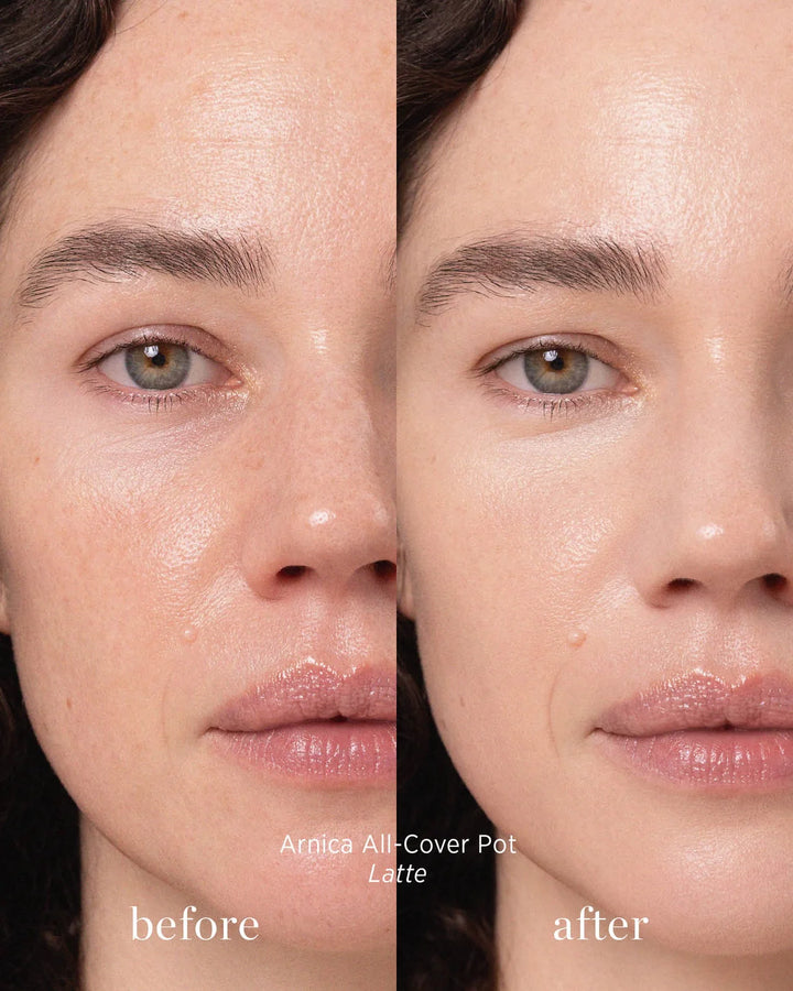 Arnica All-Cover Pot Latte Concealer Before After