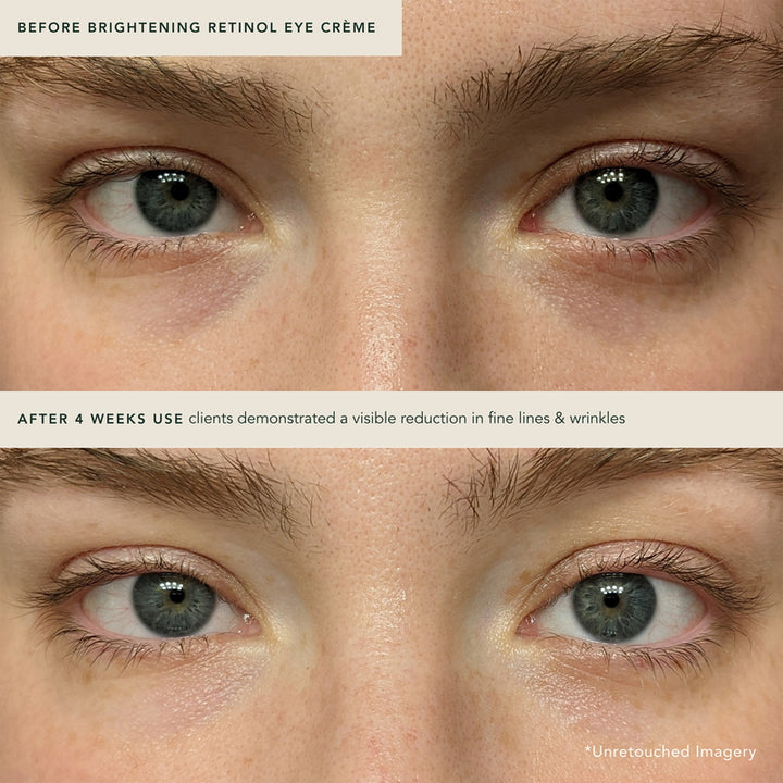 Ranavat Crema iluminadora para ojos con retinol Radiant Rani antes y después
