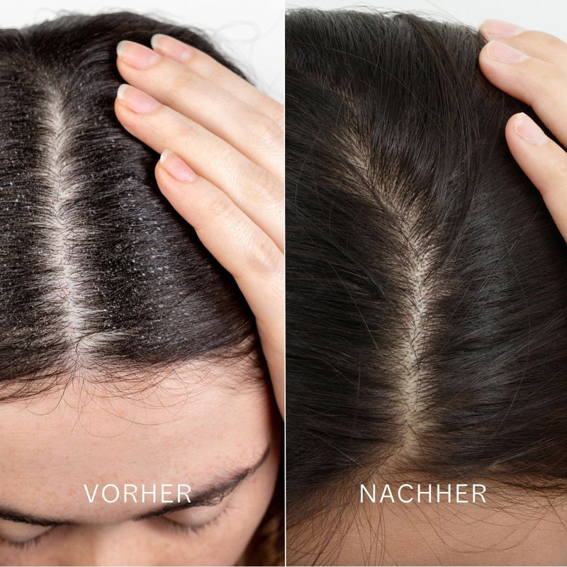 Noelie Maschera disintossicante per cuoio capelluto e capelli prima e dopo