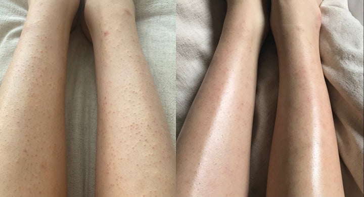 Exfoliante orgánico con sal rosa del Himalaya antes/después