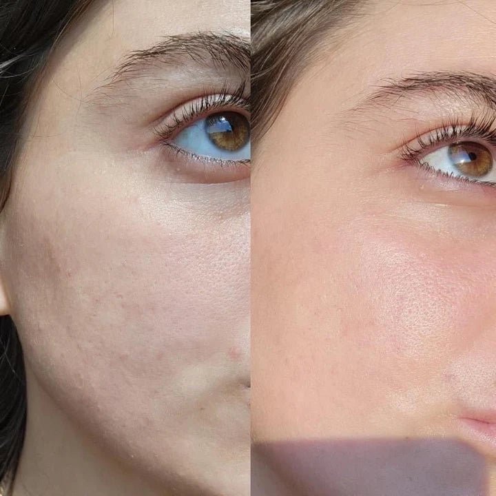 Serum of Clear Before and After Face Woman