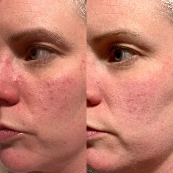 Serum of Clear Before and After Face