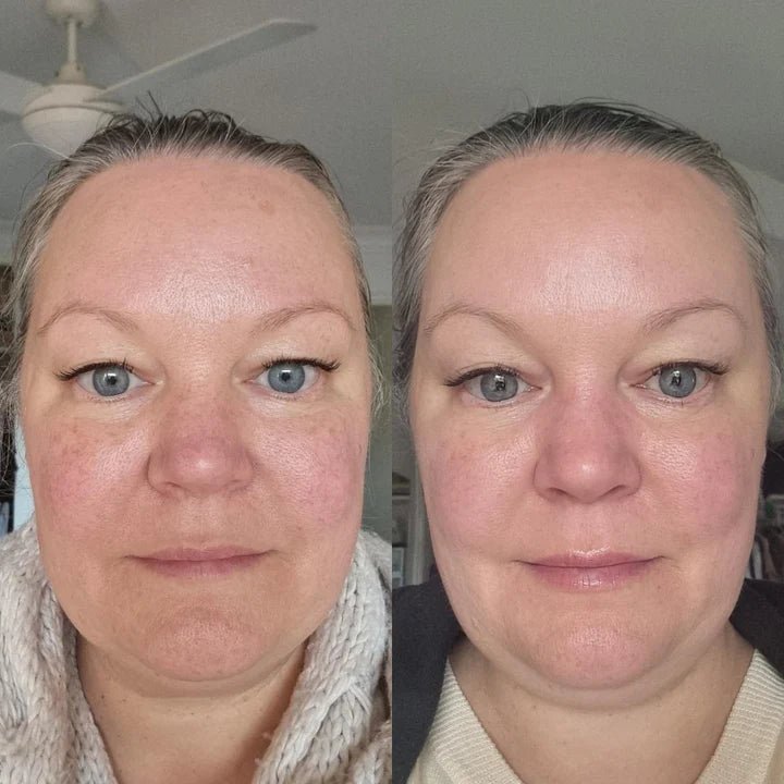 Serum of Clear Before and After Woman