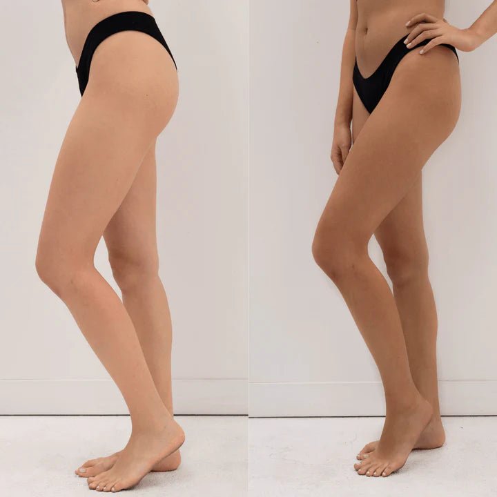 Eco By Sonya Winter Skin Before and After - Legs