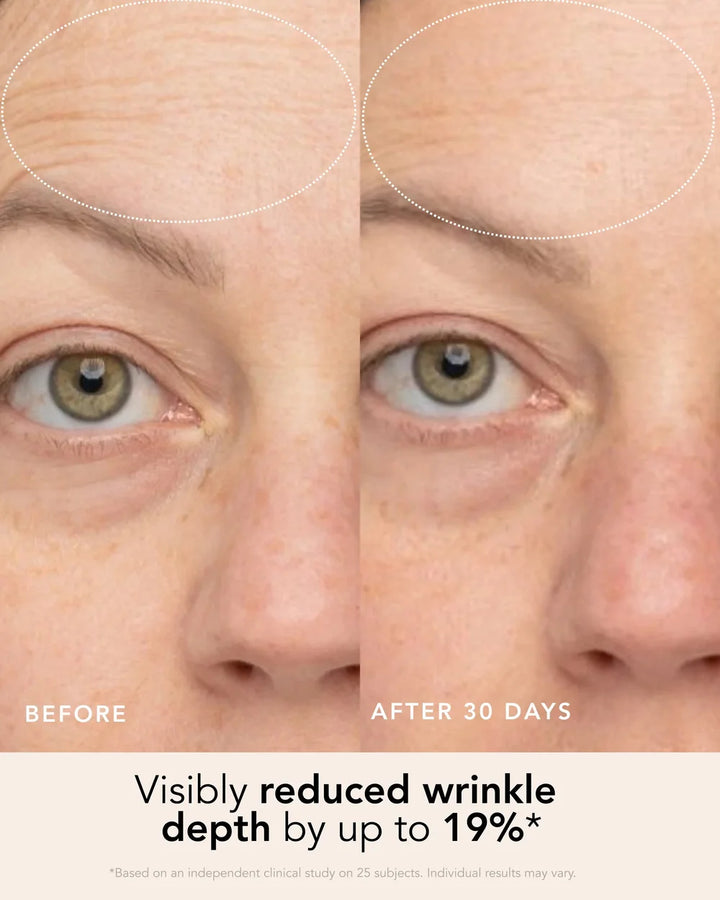 Vorher-Nachher-Bild der Augenpartie nach Anwendung des Ranavat Firming Bakuchi Serums
