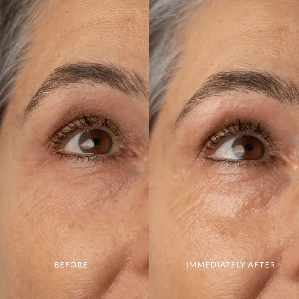 Augenpartie vor und nach der Anwendung von Glory Eyes