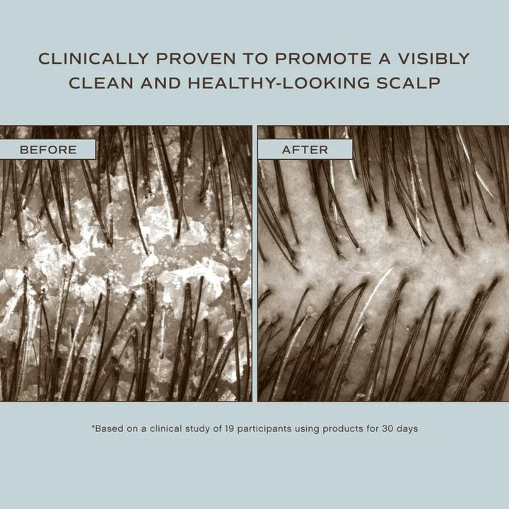 Innersense Hair Renew Scalp Hairbath - Before After
