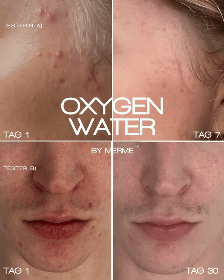 Oxygen Water - es wirkt
