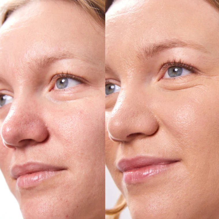 Concealer Balm Nr. 4.75 Model Before After
