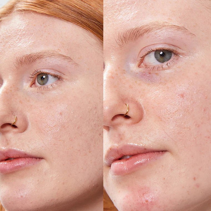 Concealer Balm Nr 4 Voher Nachher