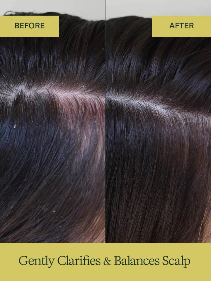 Aloe Vera Shampoo 275 ml - Blanda Beauty