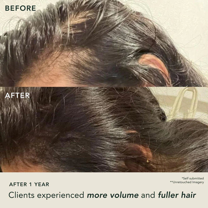 Fortifying Hair Serum Before After