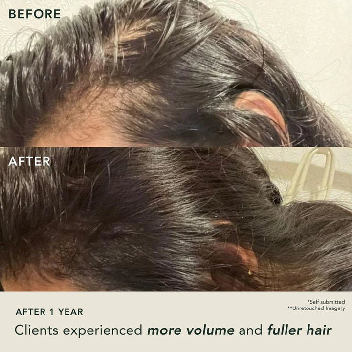 Ranavat Fortifying Hair Serum Before After Close up