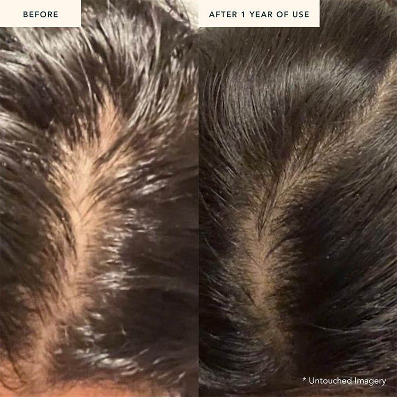 Ranavat Fortifying Hair Serum - after 1 year use