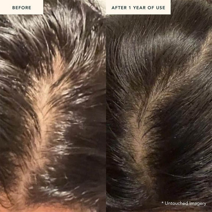 Ranavat Fortifying Hair Serum - after 1 year use