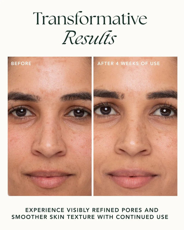 Refining Lotus Gel-Crème Results