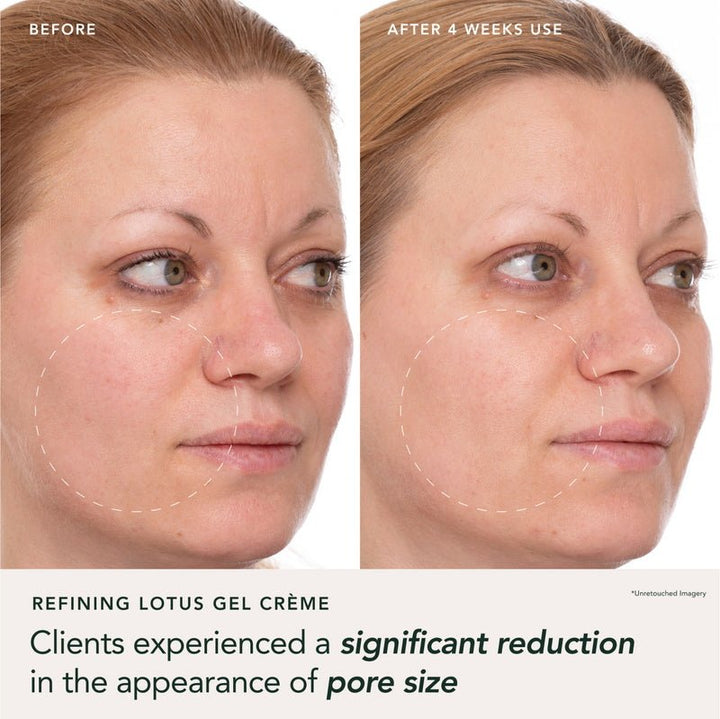 Ranavat Refining Lotus Gel-Crème - Ergebnisse Probanden 1