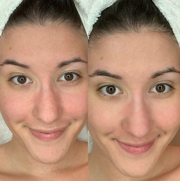 Eco By Sonya Mascarilla Facial Compost Purple Power - imagen antes y después