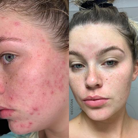 Eco By Sonya Glory Oil Certified Organic Before and After