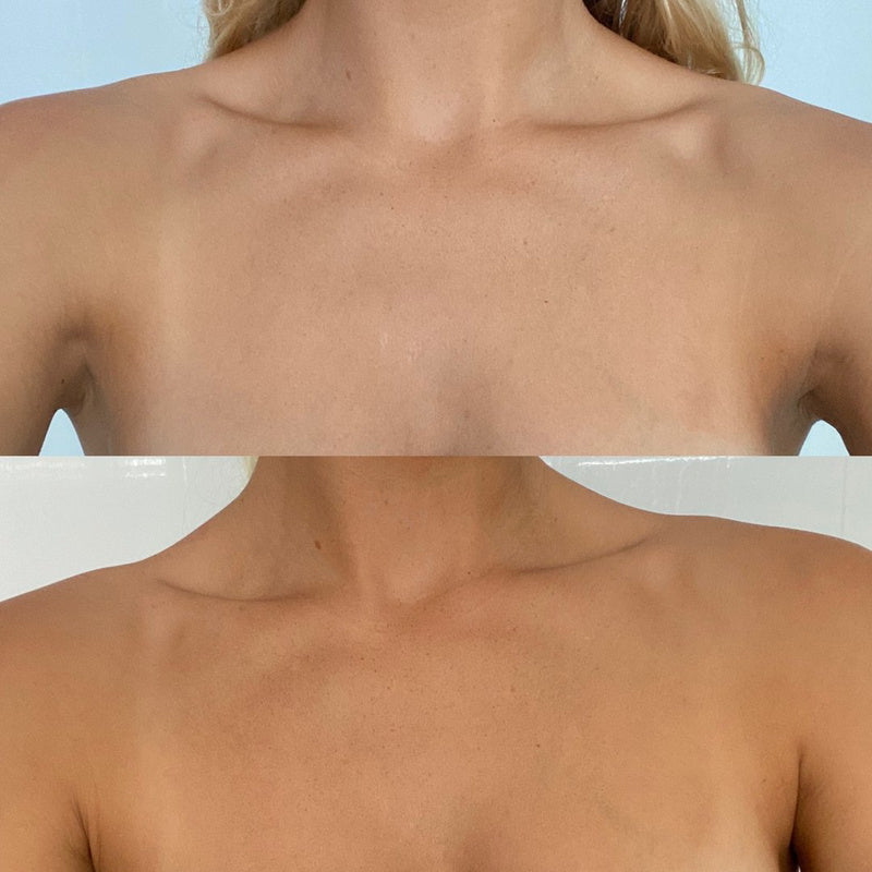 Eco By Sonya Hempitan Body Tan Water - chest before and after