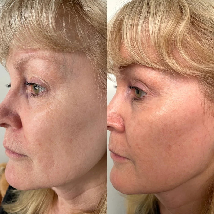 Serum of Plenty 30 ml Before and After Image
