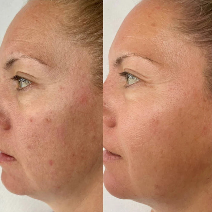 Serum of Plenty 30 ml Before and After